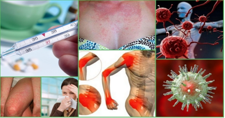 Болезнь стилла у взрослых: исчерпывающее руководство по диагностике и терапии